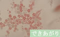 梅（ピンク）